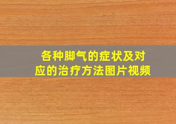 各种脚气的症状及对应的治疗方法图片视频