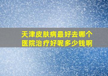 天津皮肤病最好去哪个医院治疗好呢多少钱啊