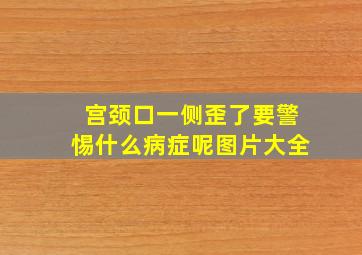 宫颈口一侧歪了要警惕什么病症呢图片大全