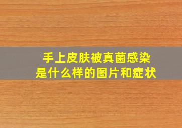 手上皮肤被真菌感染是什么样的图片和症状