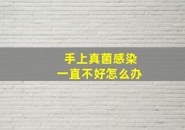 手上真菌感染一直不好怎么办