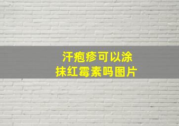 汗疱疹可以涂抹红霉素吗图片