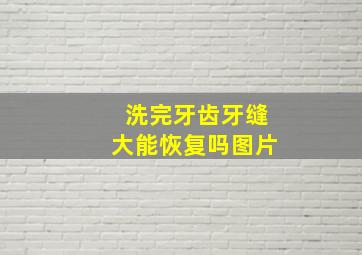 洗完牙齿牙缝大能恢复吗图片