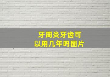 牙周炎牙齿可以用几年吗图片