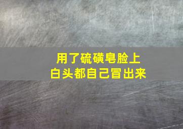 用了硫磺皂脸上白头都自己冒出来