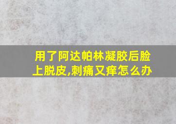 用了阿达帕林凝胶后脸上脱皮,刺痛又痒怎么办