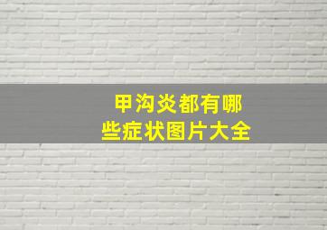 甲沟炎都有哪些症状图片大全