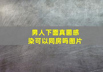 男人下面真菌感染可以同房吗图片