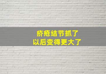 疥疮结节抓了以后变得更大了