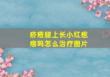 疥疮腿上长小红疙瘩吗怎么治疗图片