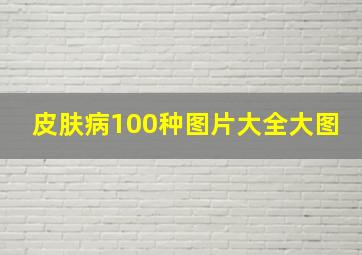 皮肤病100种图片大全大图