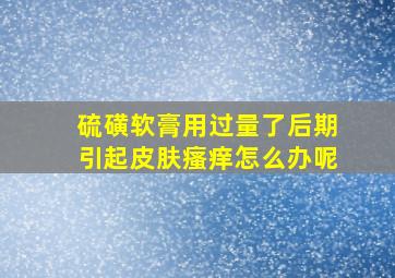 硫磺软膏用过量了后期引起皮肤瘙痒怎么办呢