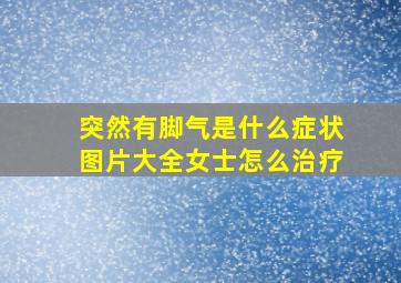 突然有脚气是什么症状图片大全女士怎么治疗