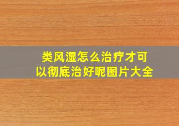 类风湿怎么治疗才可以彻底治好呢图片大全