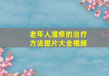 老年人湿疹的治疗方法图片大全视频