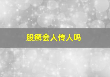 股癣会人传人吗