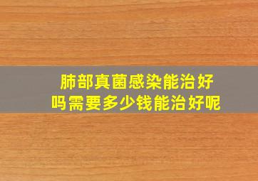 肺部真菌感染能治好吗需要多少钱能治好呢