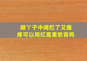 脚丫子中间烂了又瘙痒可以用红霉素软膏吗