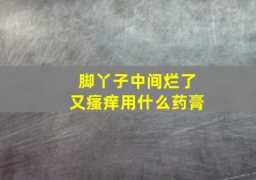 脚丫子中间烂了又瘙痒用什么药膏