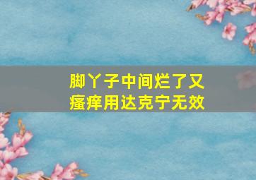 脚丫子中间烂了又瘙痒用达克宁无效