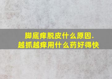 脚底痒脱皮什么原因.越抓越痒用什么药好得快