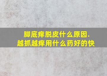 脚底痒脱皮什么原因.越抓越痒用什么药好的快