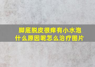 脚底脱皮很痒有小水泡什么原因呢怎么治疗图片