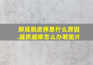 脚底脱皮痒是什么原因.越抓越痒怎么办呢图片