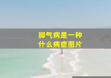 脚气病是一种什么病症图片