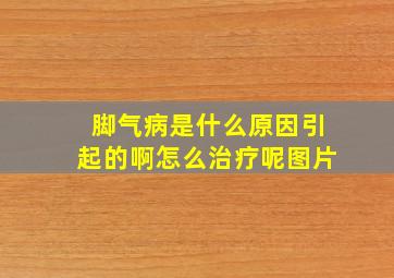 脚气病是什么原因引起的啊怎么治疗呢图片