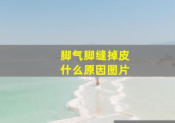 脚气脚缝掉皮什么原因图片