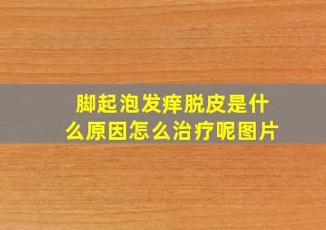 脚起泡发痒脱皮是什么原因怎么治疗呢图片