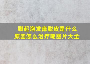 脚起泡发痒脱皮是什么原因怎么治疗呢图片大全