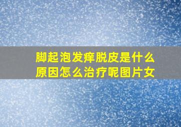 脚起泡发痒脱皮是什么原因怎么治疗呢图片女