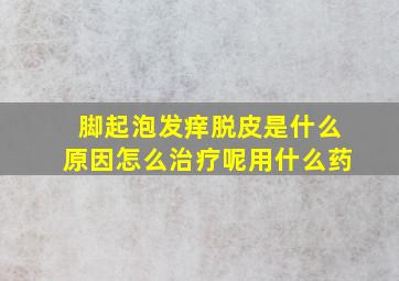 脚起泡发痒脱皮是什么原因怎么治疗呢用什么药