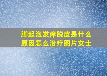 脚起泡发痒脱皮是什么原因怎么治疗图片女士