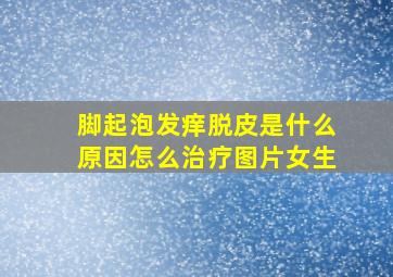 脚起泡发痒脱皮是什么原因怎么治疗图片女生