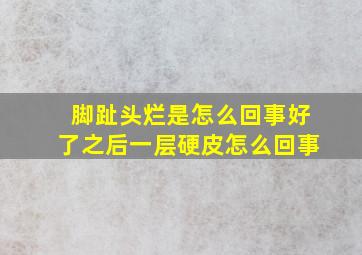 脚趾头烂是怎么回事好了之后一层硬皮怎么回事