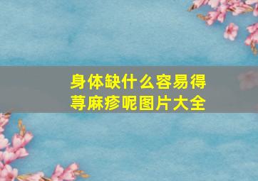 身体缺什么容易得荨麻疹呢图片大全