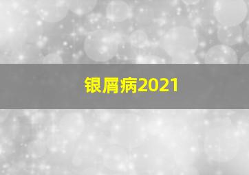 银屑病2021