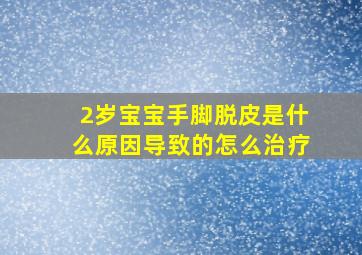 2岁宝宝手脚脱皮是什么原因导致的怎么治疗