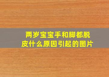 两岁宝宝手和脚都脱皮什么原因引起的图片