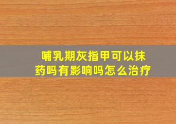 哺乳期灰指甲可以抹药吗有影响吗怎么治疗