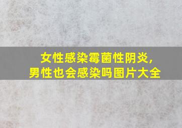 女性感染霉菌性阴炎,男性也会感染吗图片大全