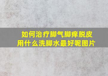 如何治疗脚气脚痒脱皮用什么洗脚水最好呢图片