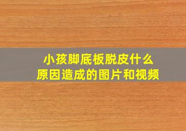 小孩脚底板脱皮什么原因造成的图片和视频