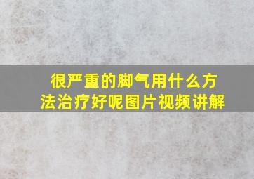 很严重的脚气用什么方法治疗好呢图片视频讲解