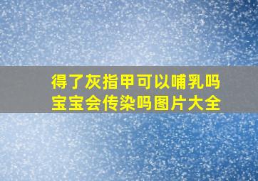 得了灰指甲可以哺乳吗宝宝会传染吗图片大全