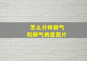 怎么分辨脚气和脚气病症图片