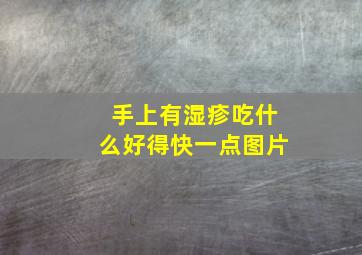 手上有湿疹吃什么好得快一点图片